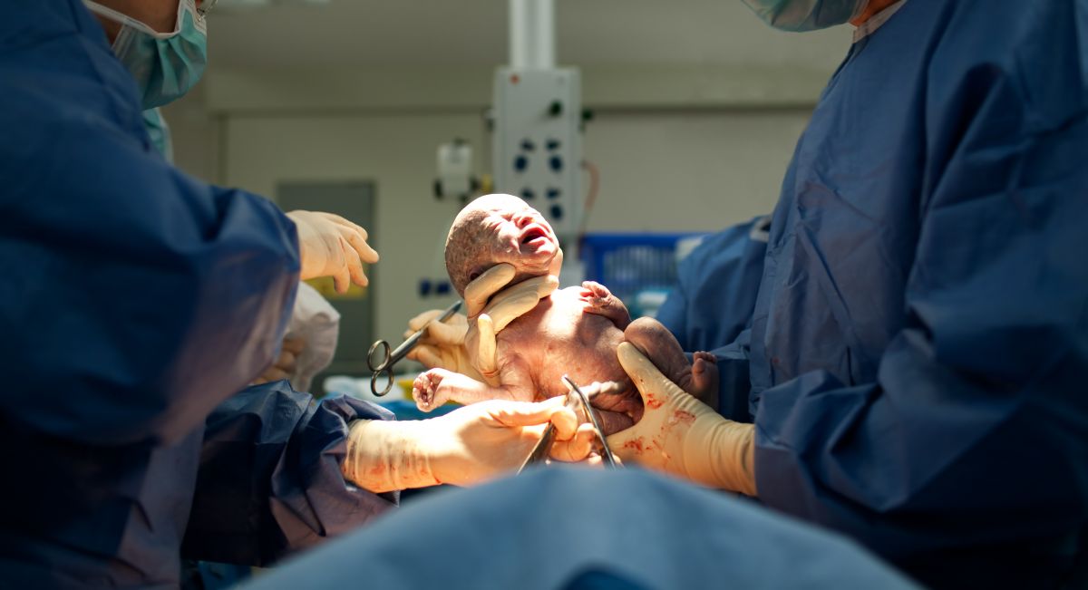 naștere prin cezariană la brașov