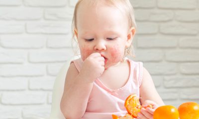 copil alergic mananca citrice