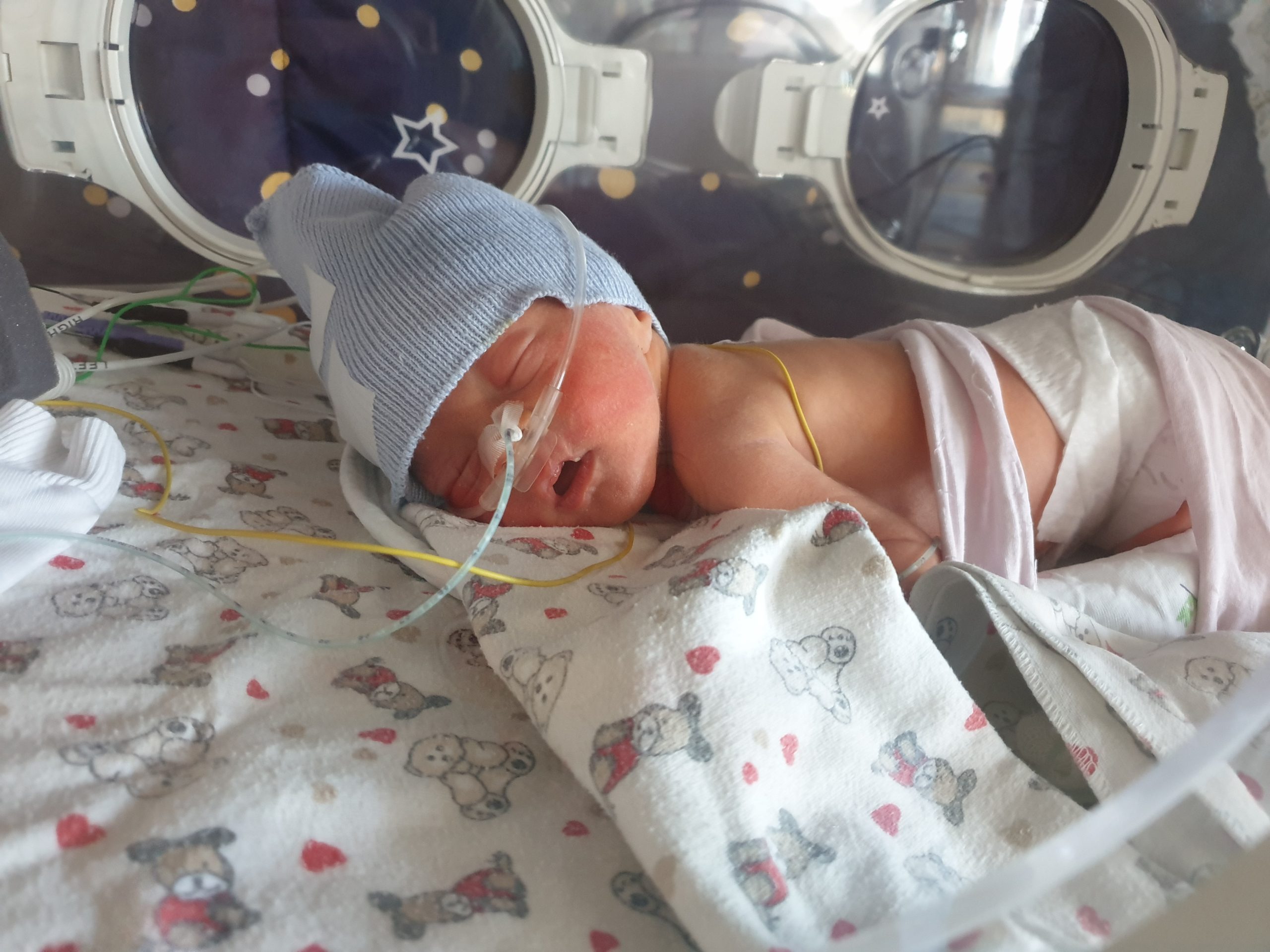 „Copilul s-a născut cu scor Apgar 2, a fost resuscitat și intubat. S-a recuperat complet!”