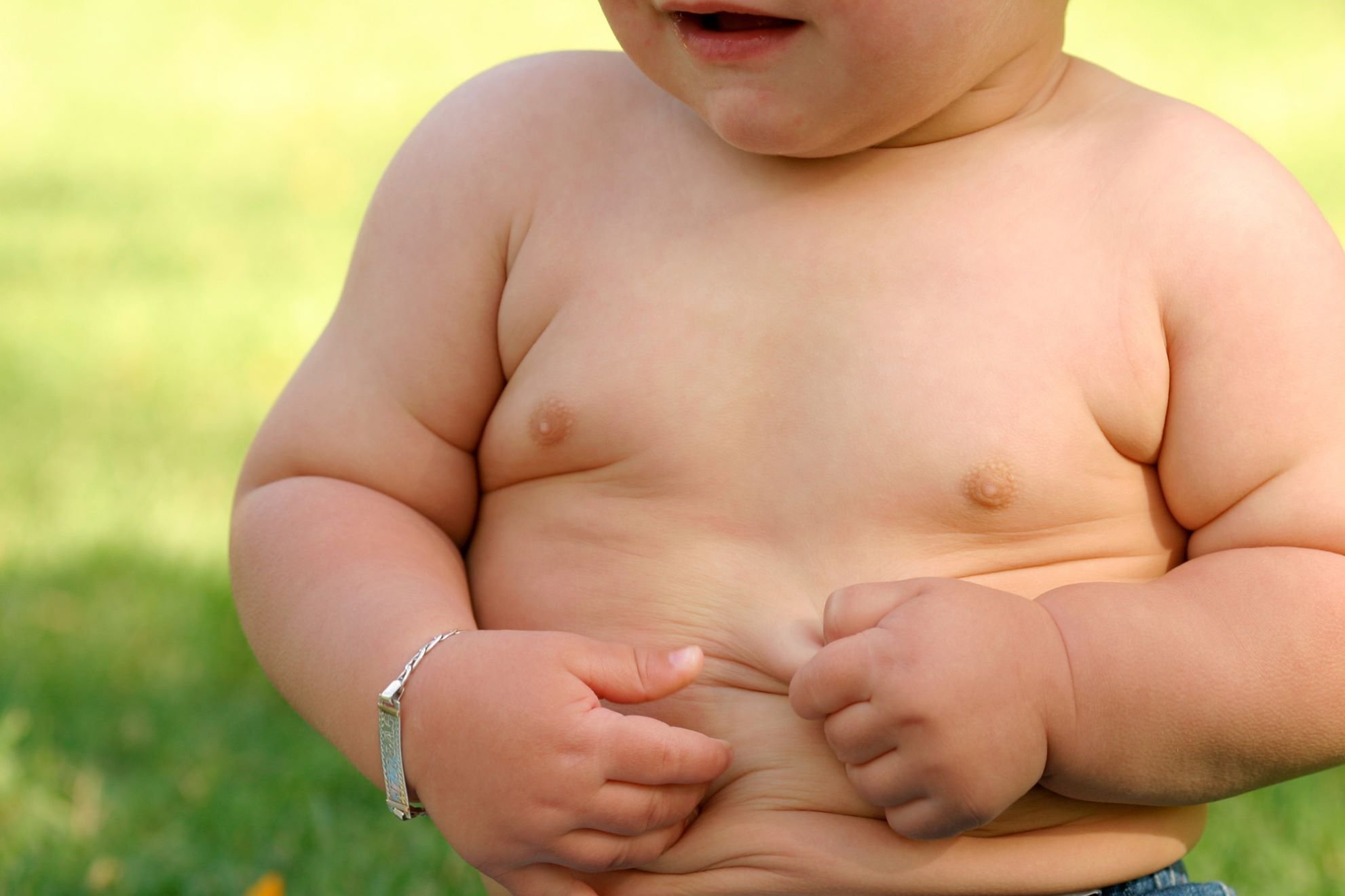 Studiu: Obezitatea infantilă apare cu o frecvență mai mare și la vârste mai mici decât în urmă cu un deceniu.
